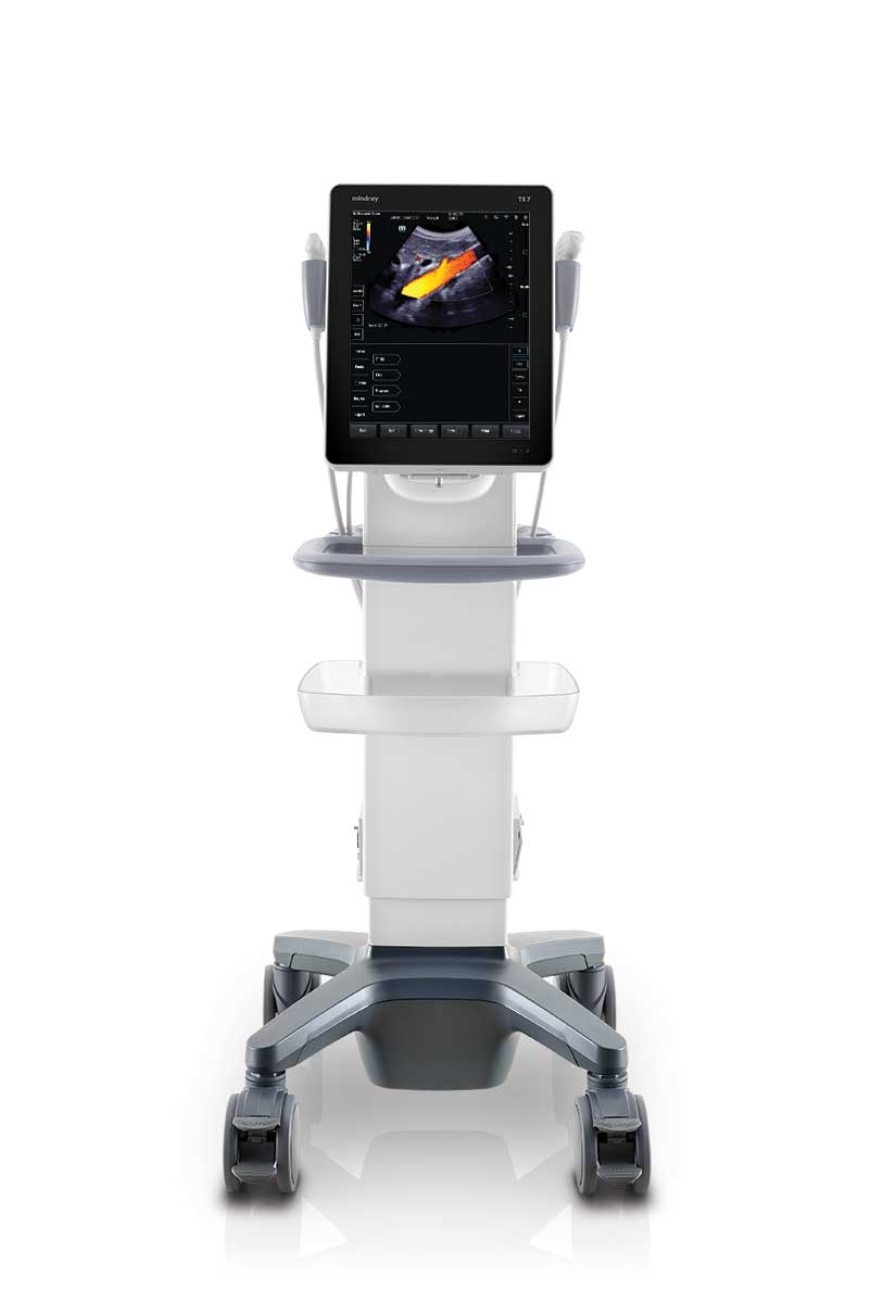 Tablet Ultrasound