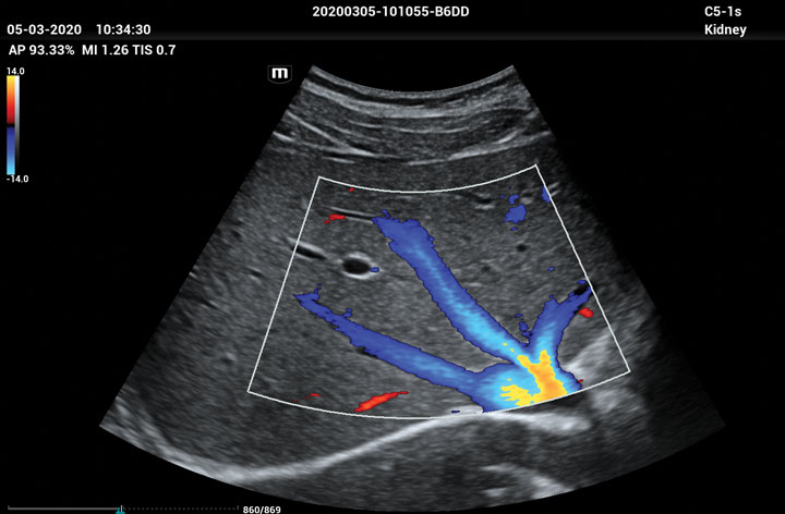ME8 Image: Liver using C5-1s