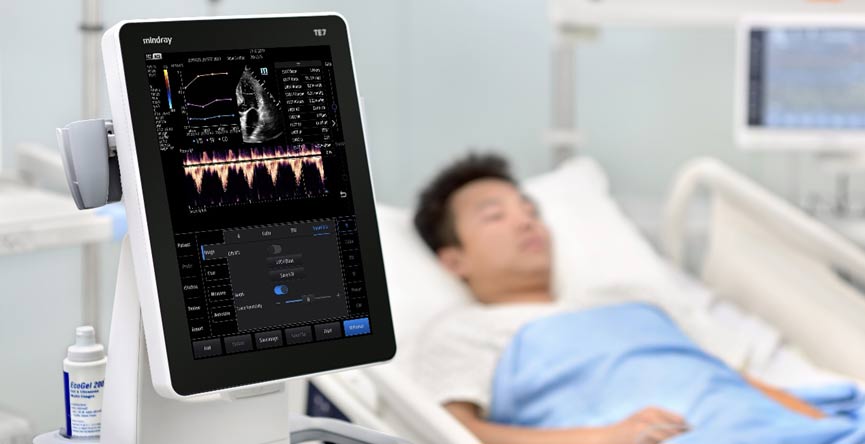 Point of Care Ultrasound Technology (POCUS) With AI