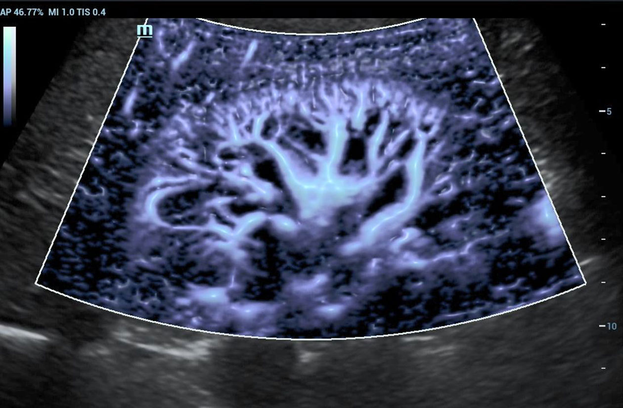 Resona 7 Image: Glazing Flow displaying microvasculature of the kidney using SC6-1U
