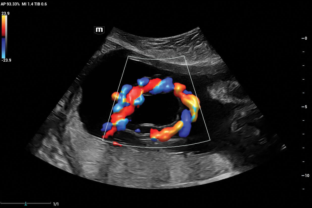 color ultrasound image