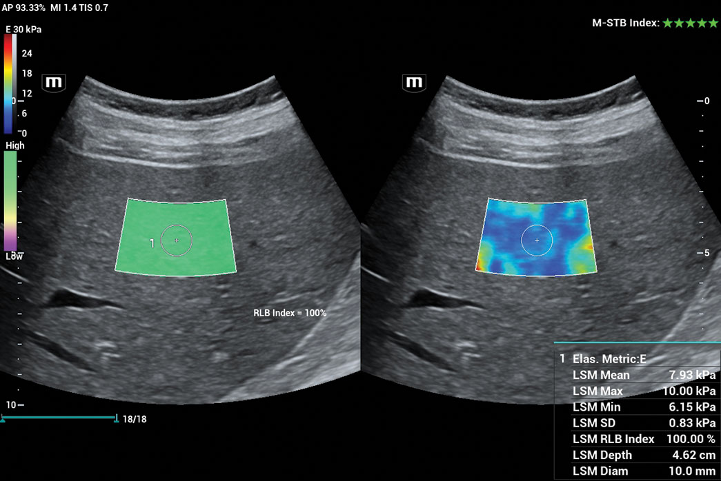 high quality ultrasound image