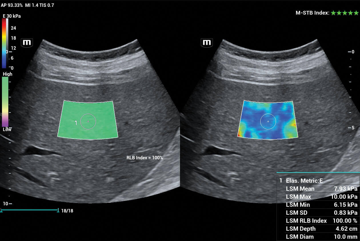 high quality ultrasound transducer