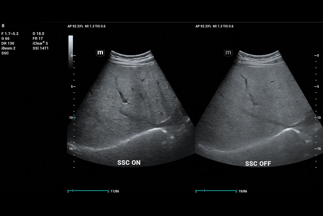 ultrasound for doctors
