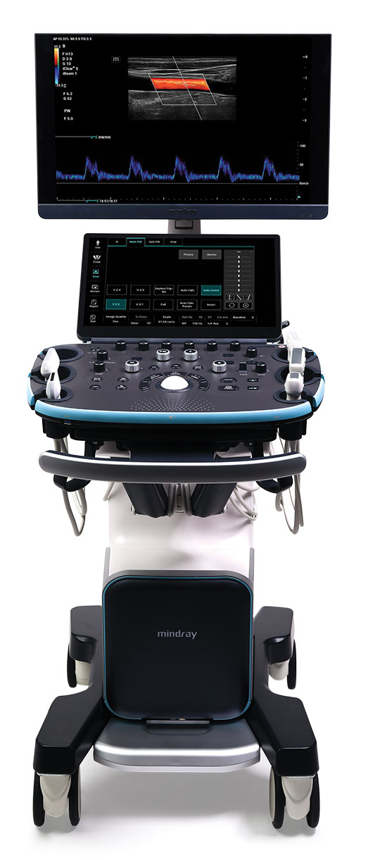 ultrasound machine resona i9