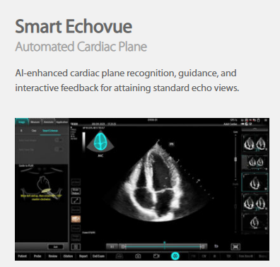 smart ultrasound for sale
