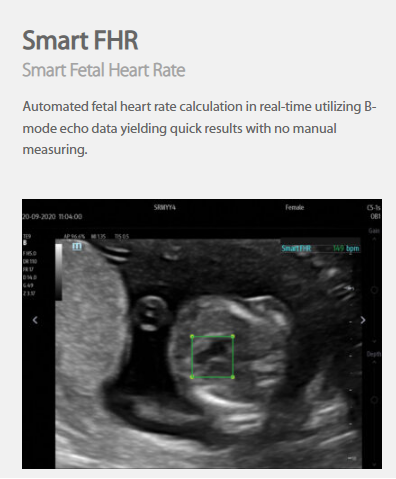 buy smart ultrasound