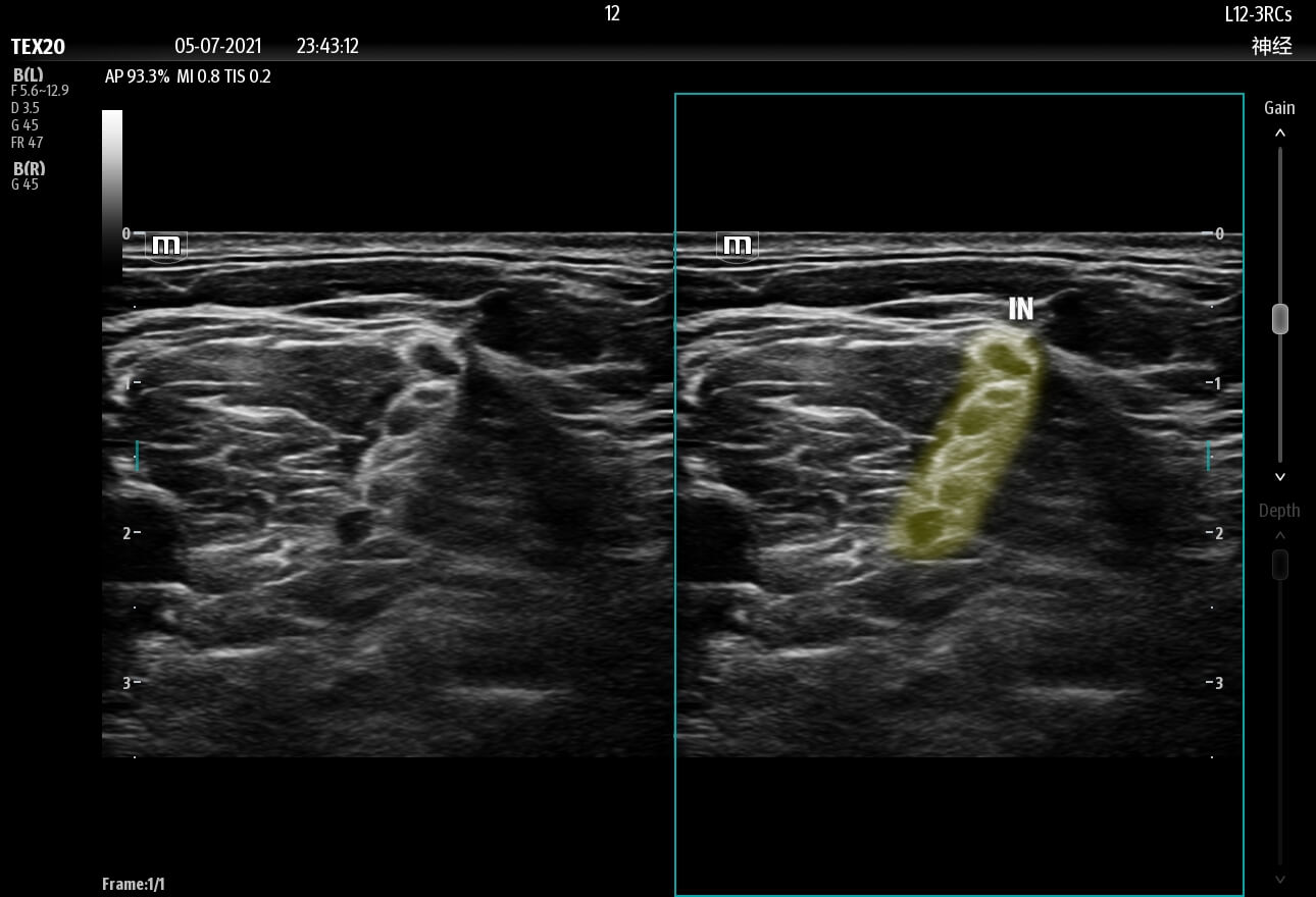 smart ultrasound imagery