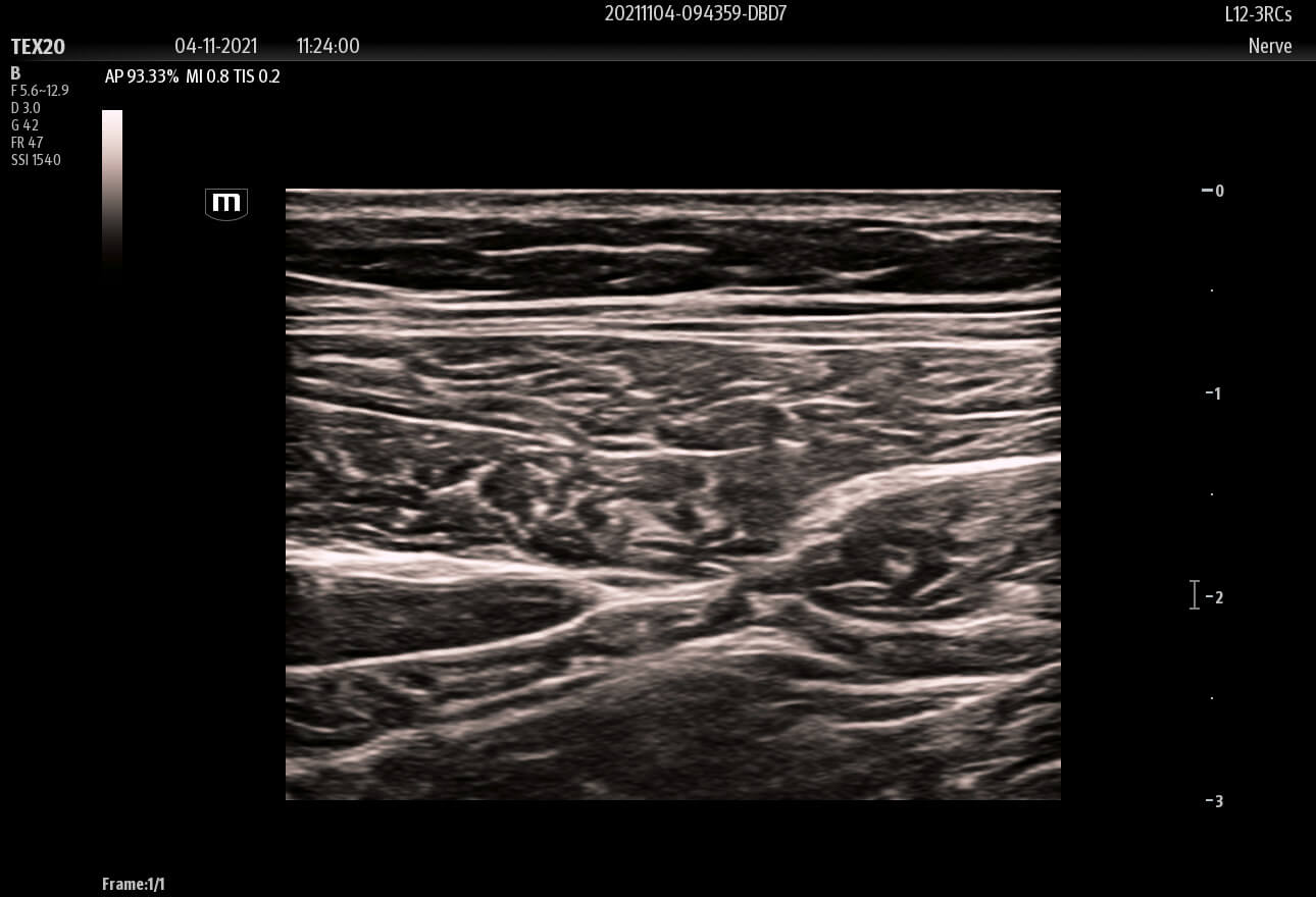 ultrasound technology scan