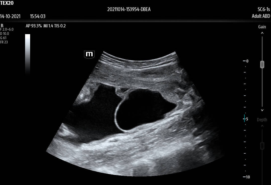 te x ultrasound image