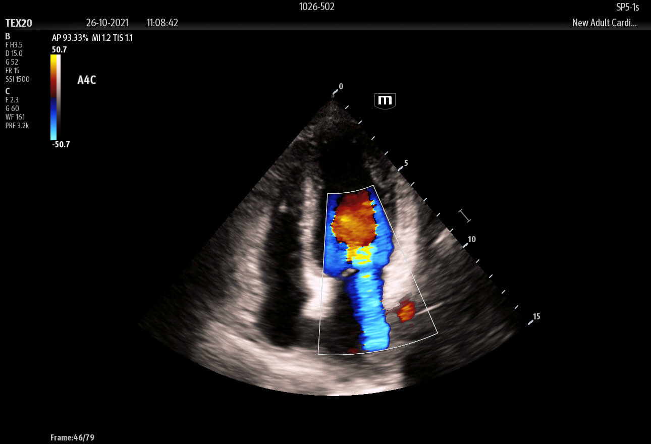clinical ultrasound imagery