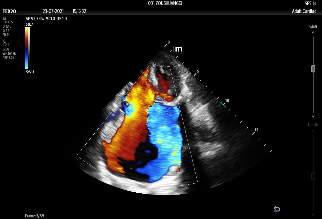 ultrasound imagery