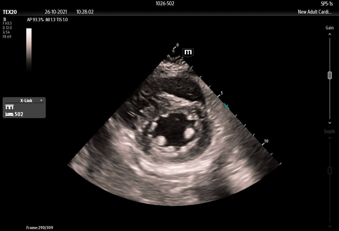 clinical ultrasound
