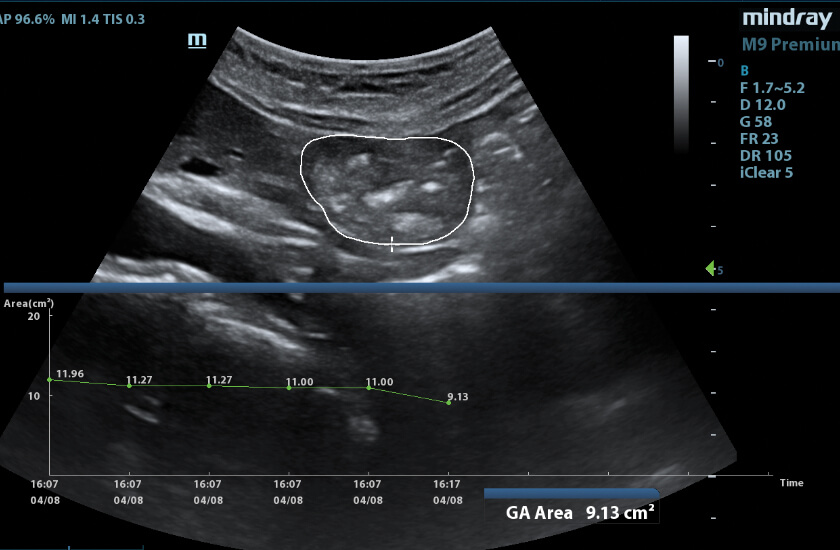 ultrasound imagery from m9 machine