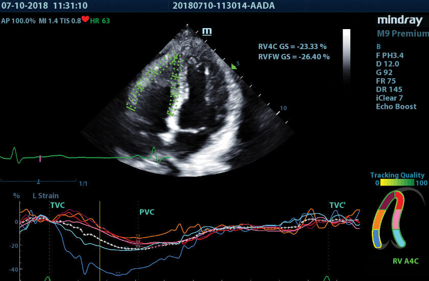 ultrasound image from m9 machine