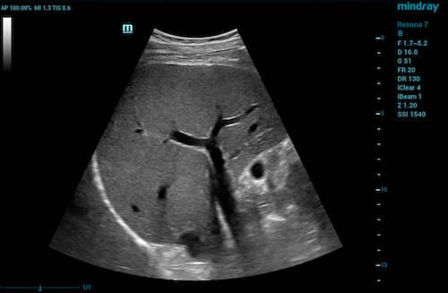 ultrasound transducer image