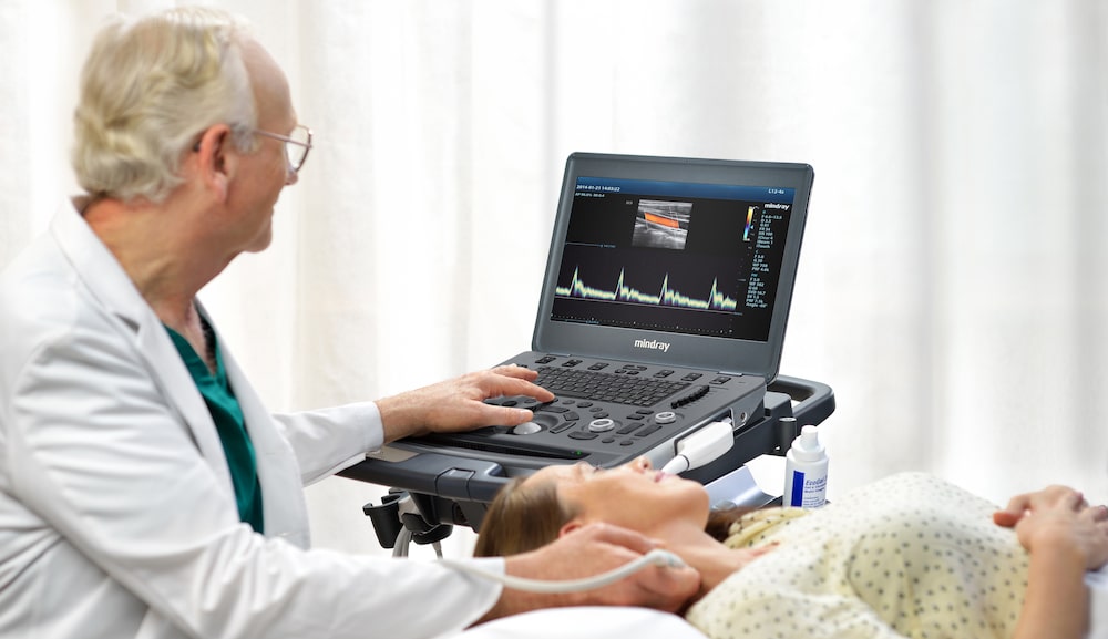 doctor using vascular ultrasound