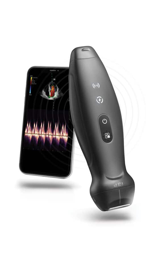 TE7 Max Ultrasound System