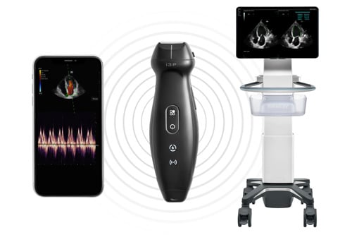 Wireless Ultrasound Probe Increases Imaging Accessibility - Ultrasound -  mobile.